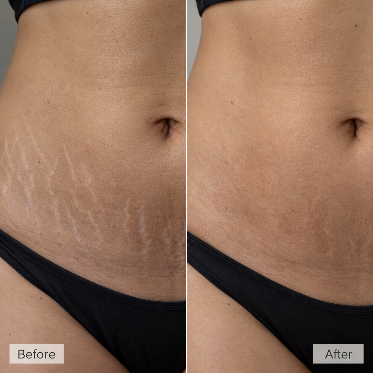 Before treatment