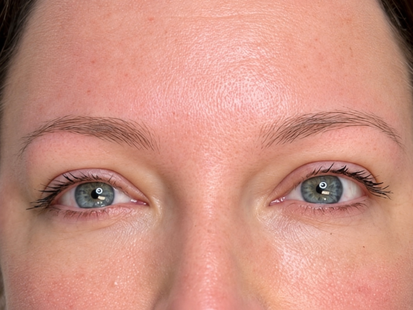 Before treatment
