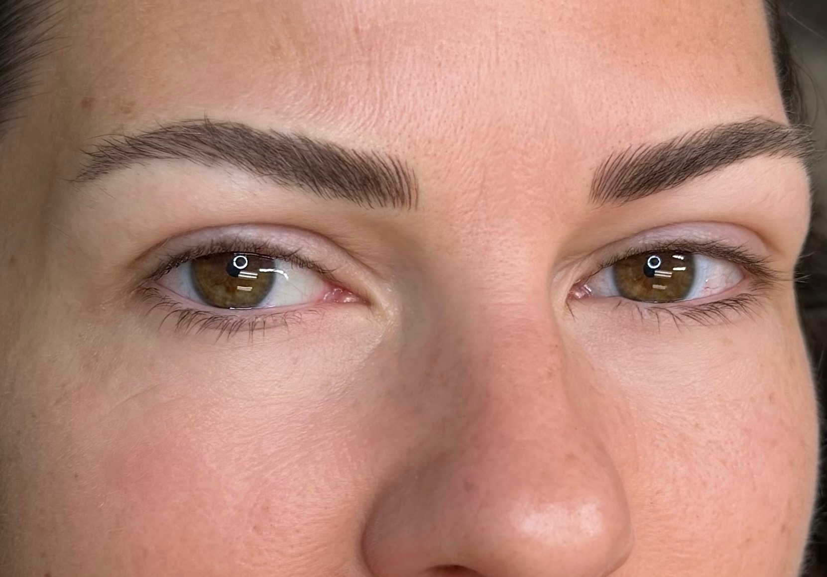 After brow treatment