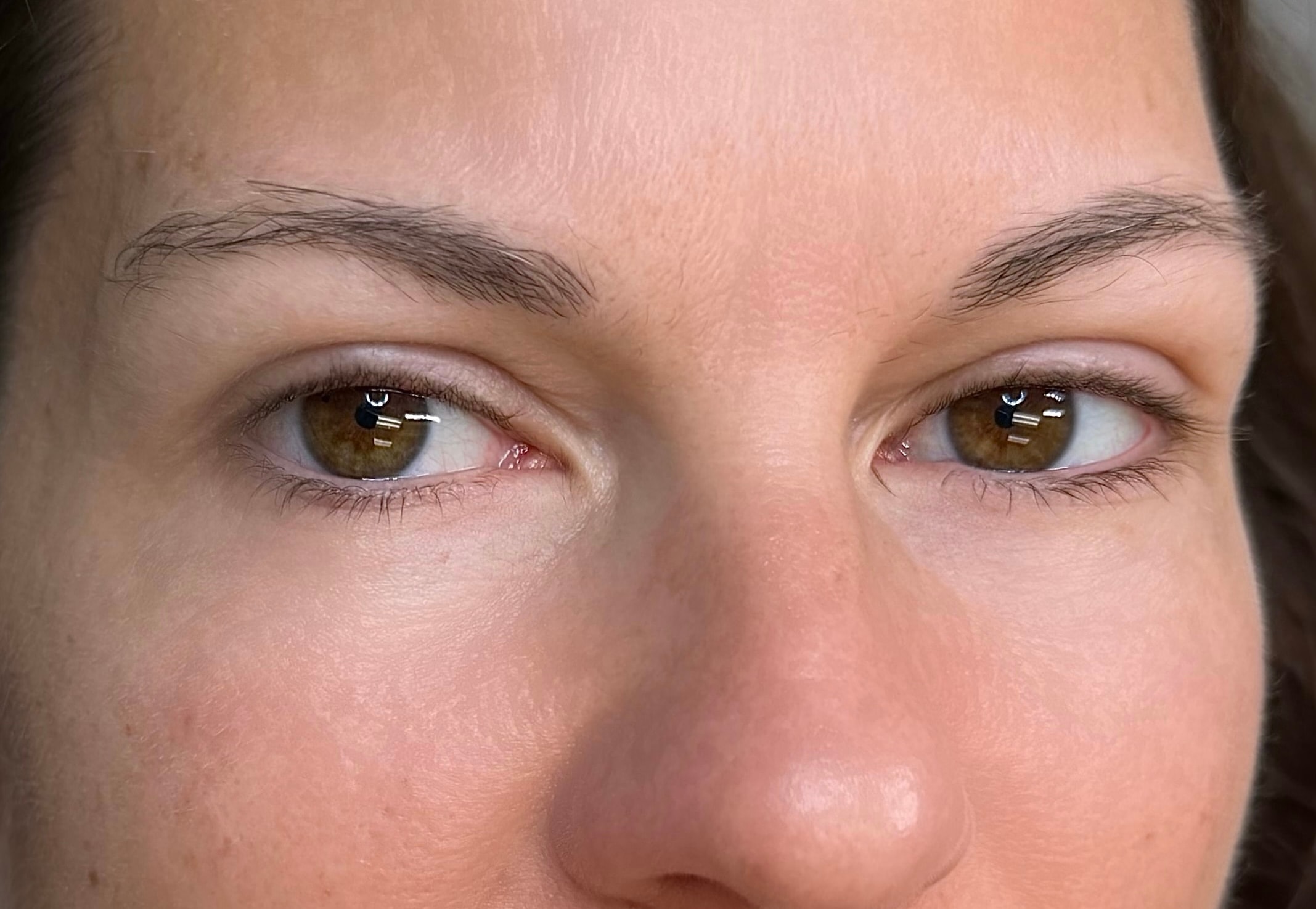 Before brow treatment
