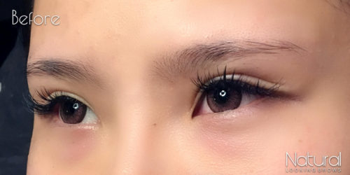 Asian-Microblading-Before